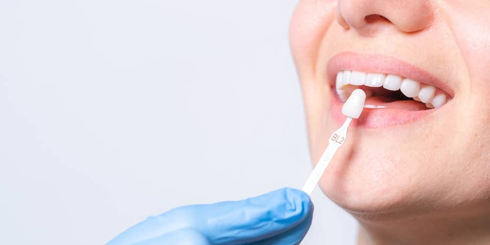 A closeup view of a woman's mouth while a dentist applies a dental veneer