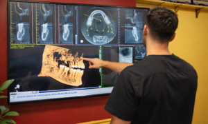 A dentist at Dental Depot DFW inspects x-ray scans of teeth for dental implants.
