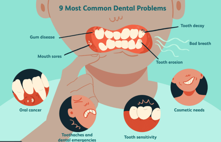 Illustration of most common dental problems