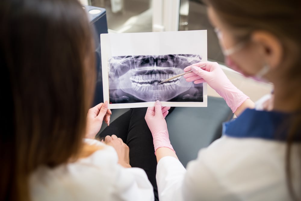 Two dentists examine a X-ray of a mouth from a dental emergency